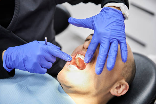 Best Emergency Dental Filling Replacement  in Beacon, NY